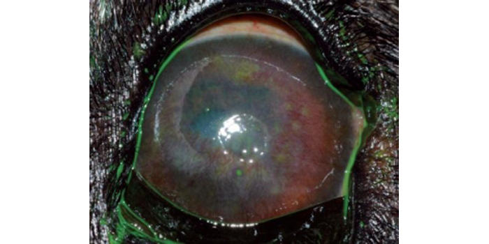 Uso de ciclosporina y otros inmunomoduladores en oftalmología